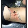 Anthony Lombardi – Chronic Low Back Pain Assessment & Treatment