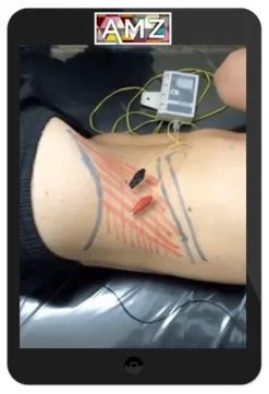 Anthony Lombardi – Chronic Low Back Pain Assessment & Treatment